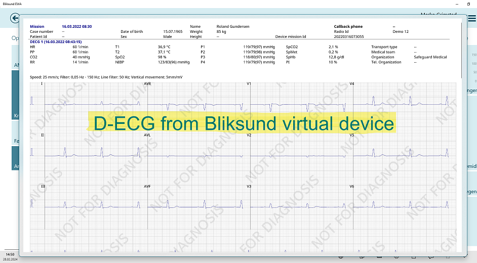 ECG