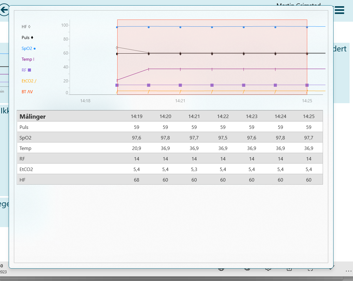 Measurements from Corpuls